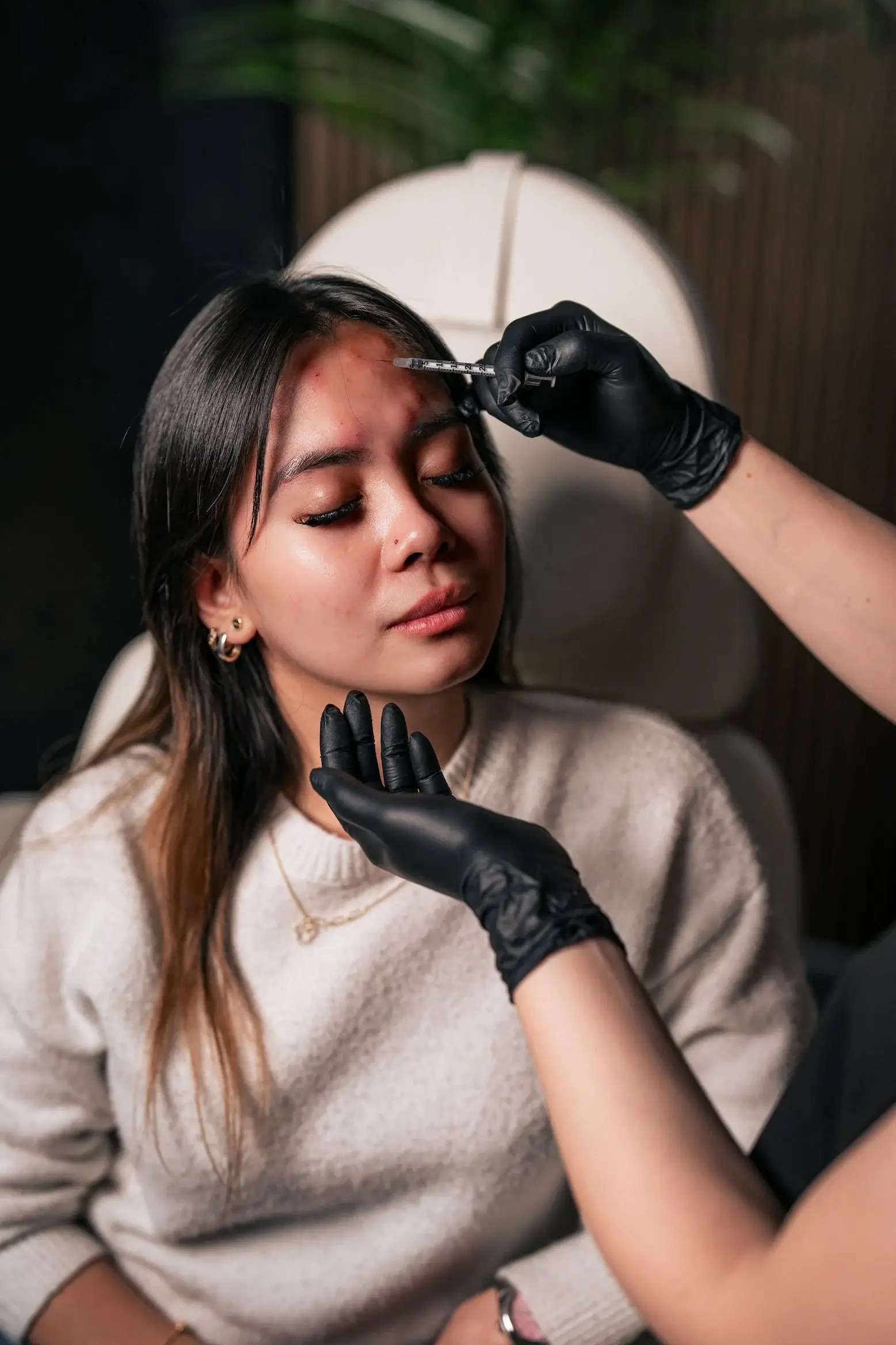 A Botox injection placed between a patient’s brows