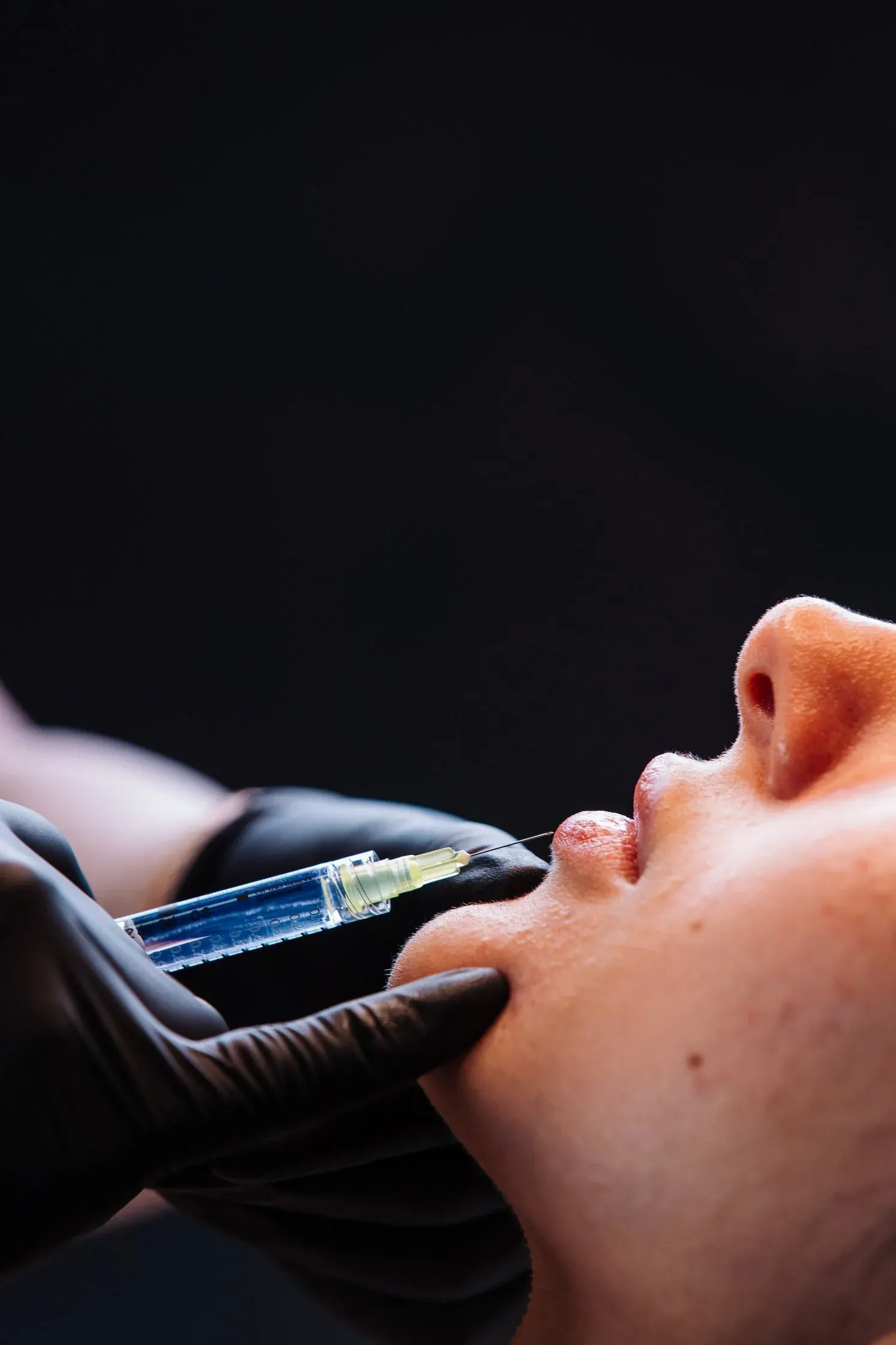 Close view of a lip filler injection against a black background