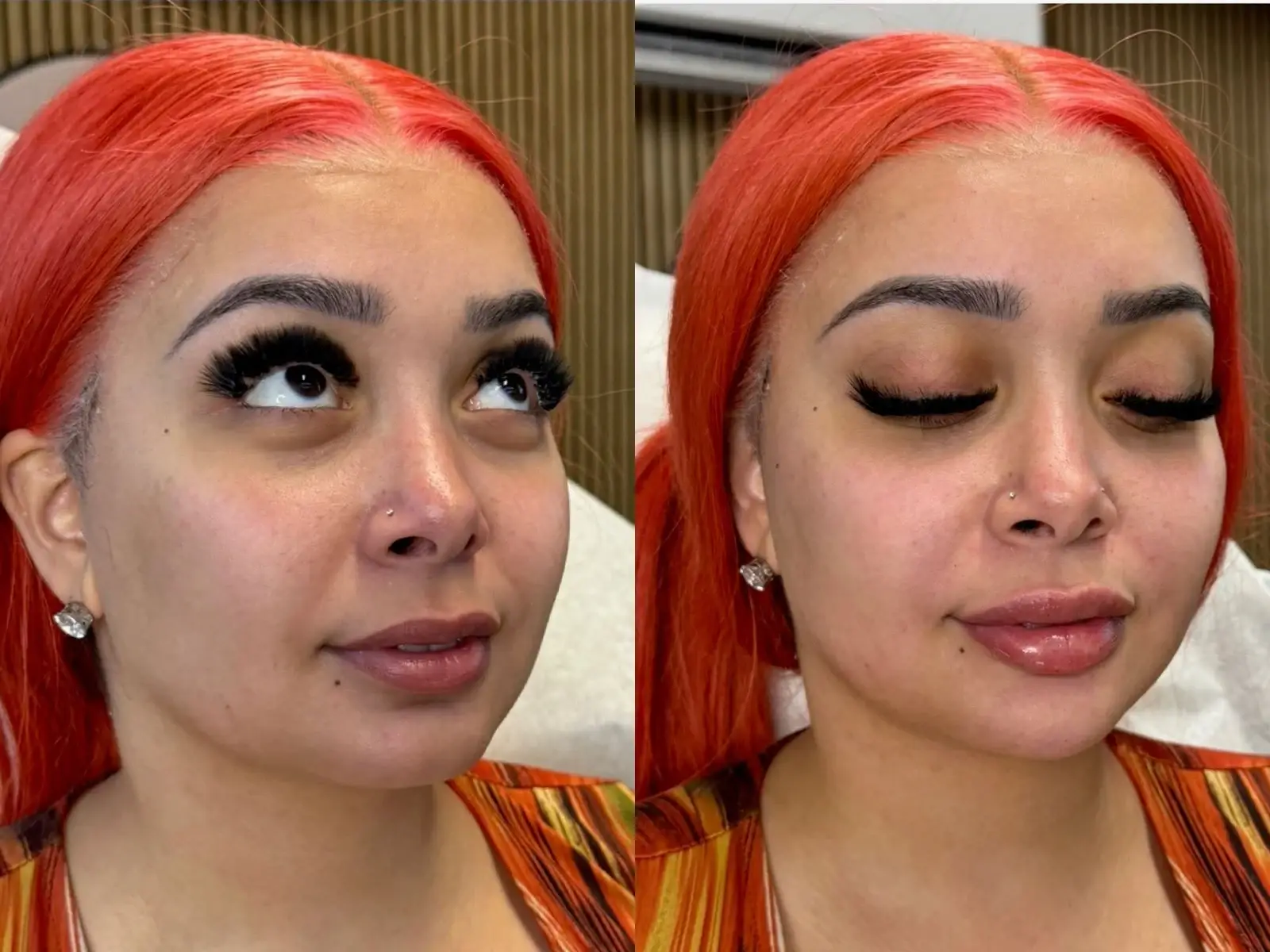 Two views of the face of a patient with bright red hair